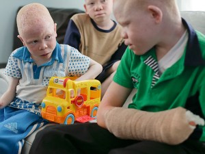 Niños albinos cazados se recuperan y cuentan con refugio tras ataque