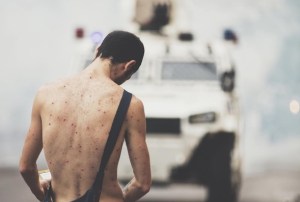 El venezolano que manifestó desnudo teme por su familia
