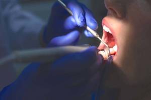 Dentista de Las Vegas incendió boca de niña